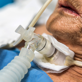 Intensivpflege Tracheotomie Foto iStock PongMoji.jpg